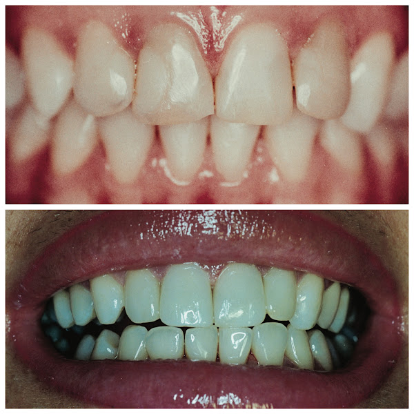 Foto 1 Dr. Mauricio Lara Odontologia - Dentista Sorocaba